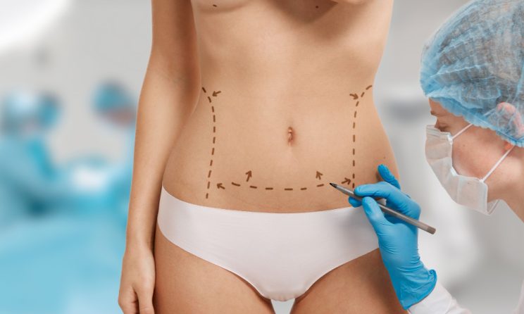 prețuri abdominoplastie